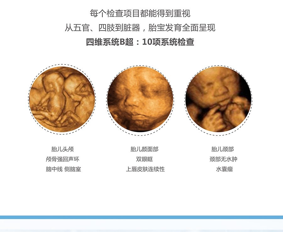 4、四维彩超图片胎儿全图:孕期四维彩超的图片