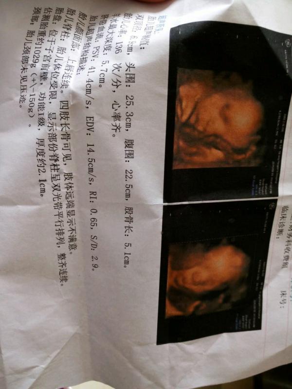 1、四维彩超图片胎儿全图:七个月四维彩超图片，看下是男孩女孩？