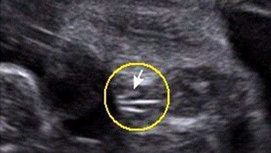 2、四维彩超图片胎儿全图:四维彩超上的图片分别是宝宝的哪里，都会看的亲吗？？